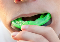 Shelley Shearer: Mouthguards are an essential back-to-school item to protect student-athletes
